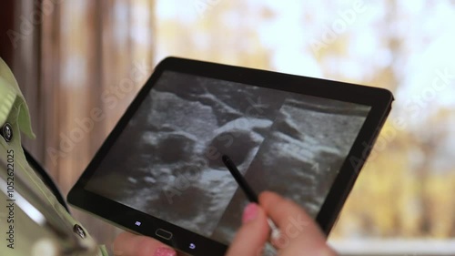 Ultrasound examination of the thyroid gland.