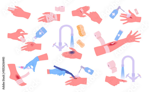 Injured human hands. First aid for fracture, body skin burn and cut, medical treatment for arms injury flat vector illustration set. Cartoon injured hands and medical treatment