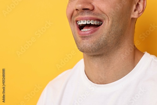 Happy man with dental braces on yellow background, closeup. Space for text photo