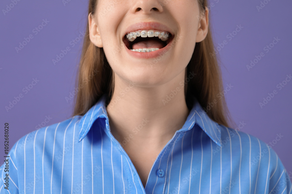Girl with braces on purple background, closeup Girl with braces on purple background, closeup