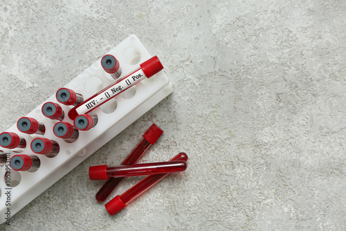Hiv blood test tube with ne...