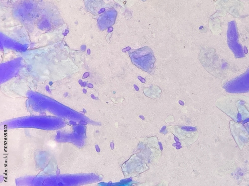 Fototapeta premium Microscopic view of Malassezia pachydermatis cells taken from dog with ear infecion