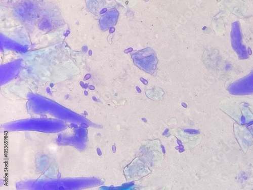 Microscopic view of Malassezia pachydermatis cells taken from dog with ear infecion