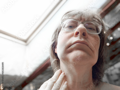 A middle-aged woman showing signs of domestic violence with a swollen cheek and bruise caused by a bad tooth infection