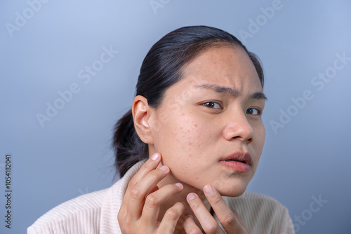 Asian teenage girls who have problems with uneven facial skin, acne invasion, inflamed acne, clogged pores, chronic acne problems. Red marks on cheeks, sensitive skin, skin care concepts.