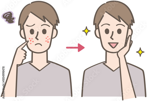ニキビ肌からキレイな肌になった人