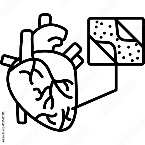 Coronary Artery Bypass Graft Icon