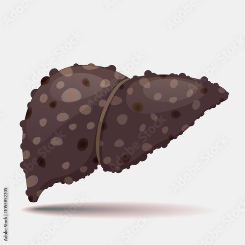 Liver cirrhosis icon vector illustration.