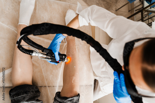 Fotografi Laser epilation targeting the hair follicles at their roots
