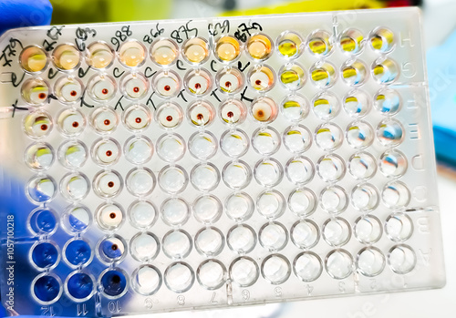 Hemagglutination assay for T. pallidum antibodies. TPHA. ELISA plate, serology testing method in medical laboratory photo