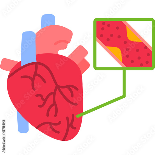 Coronary Artery Bypass Graft Icon