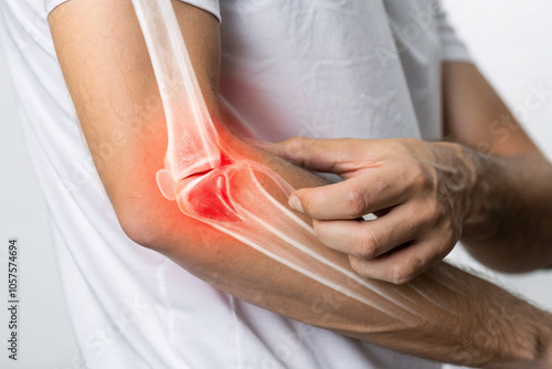 Elbow Pain Illustration with X-Ray Highlighting Tendonitis – Medical Concept Image for Injury and Joint Issues