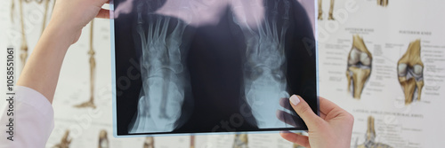 Doctor holds X-ray picture of patient feet in hospital