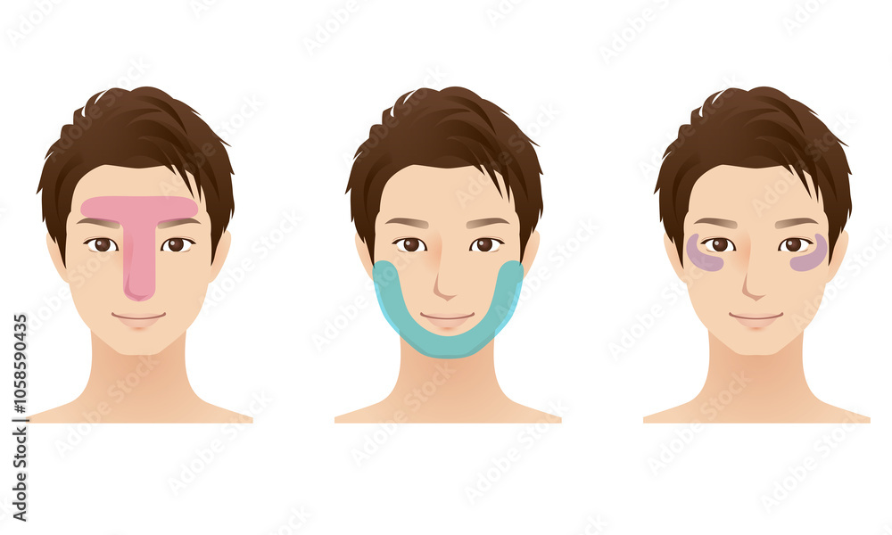 男性　美容　Tゾーン　Uゾーン　Cゾーン