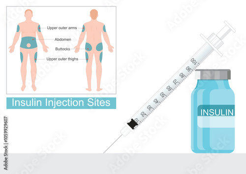 Injection sites suitable for an insulin injection.