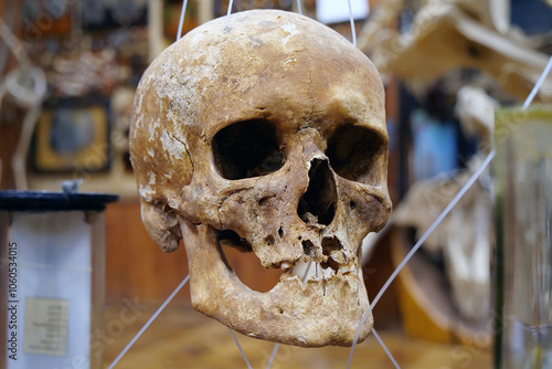 Bones of human skull for studying. Human skull