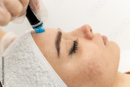 Professional cosmetology. A smart, qualified cosmetologist uses modern equipment to perform the Hydrafacial hydrofacial procedure. Girl with problem skin