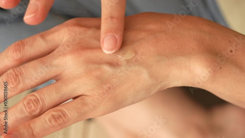 Overhead Close-Up of Woman’s Hands Applying Transparent Gel – Dermatological Topical Therapy Concept