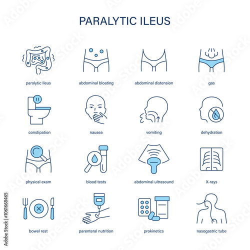 Paralytic Ileus symptoms, diagnostic and treatment vector icons. Medical icons.