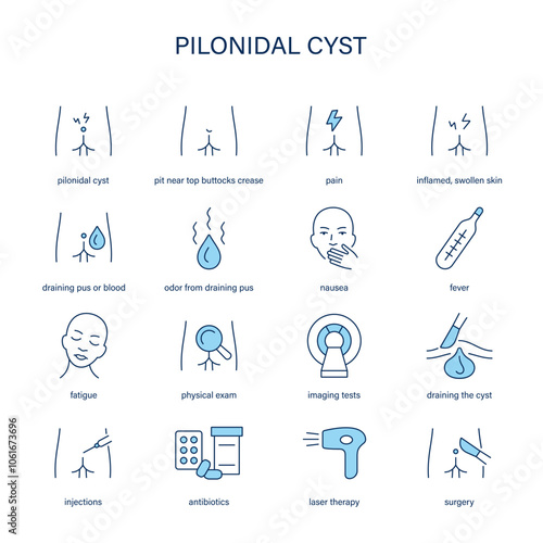 Pilonidal Cyst symptoms, diagnostic and treatment vector icons. Medical icons.