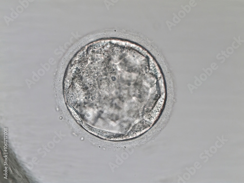 Hatched human blastocyst. Grade CB. on the fifth day of development. Microscope view. photo