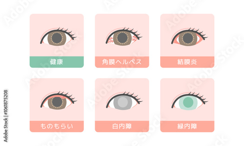目の病気　イラストセット