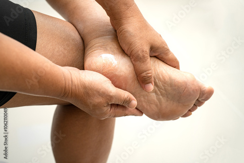 Asian woman care feet with cracked and dry heel skin cream at home.