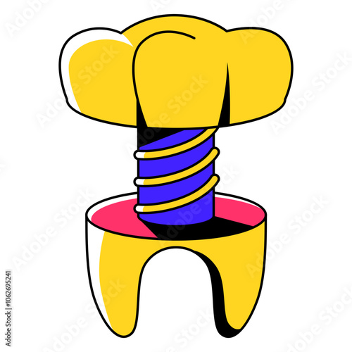 Tooth Implant Illustration
