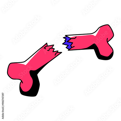 Bone Fracture Illustration