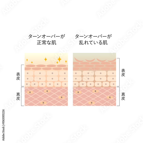 図版_肌図版_015_肌のターンオーバー