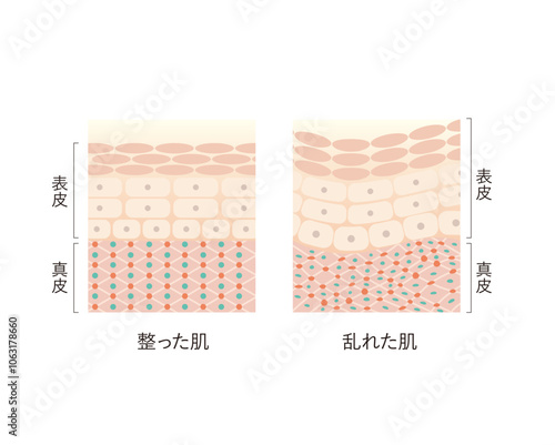 図版_肌図版_031_整った肌と乱れた肌