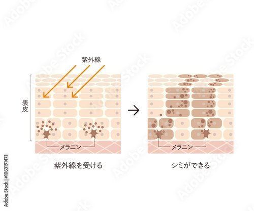 図版_肌図版_033_シミができる