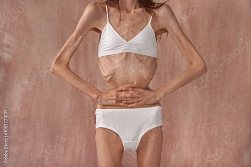 Принти на полотні Skinny young woman with anorexia on free background