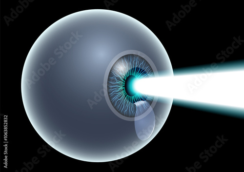 LASIK eye surgery