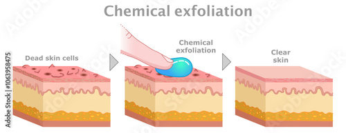 Chemical exfoliation section. Face, body serums,  creams, Ahas, face smoother. Skin care, old dead cells. Before, after. Vector illustration