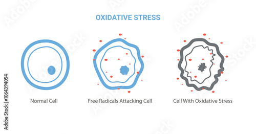 Oxidative Stress cell diagram. Free radicals attacking cell
