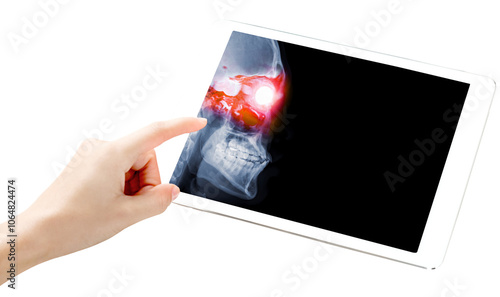 Картината върху платно A hand points at a tablet screen displaying an X-ray image of the skull with a brightly highlighted orbital area isolated on a white background with Clipping path