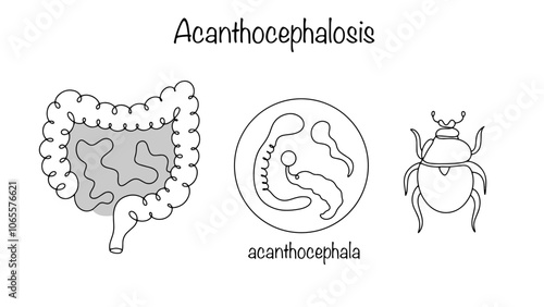 Acanthocephalosis