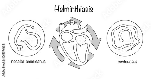 Helminthiasis. Circulation