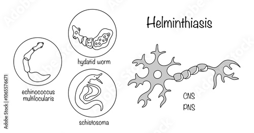 Helminthiasis. Nervous system