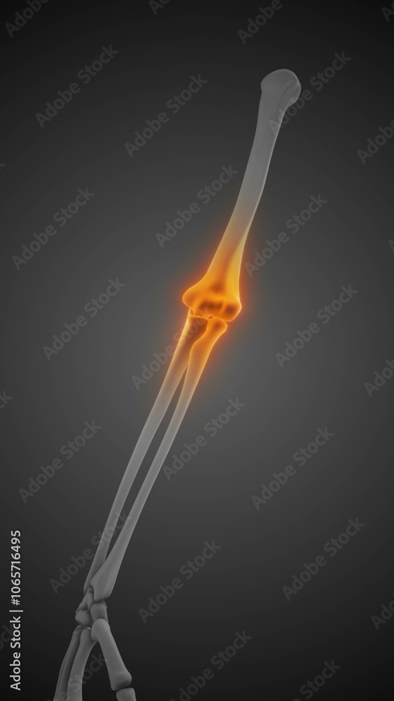 Human skeleton anatomy elbow pain Human skeleton anatomy elbow pain