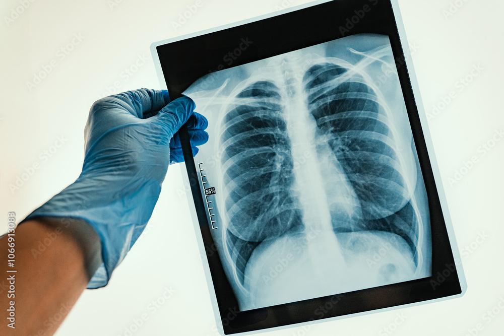 Xray Imaging of Human Lungs Conducted for Comprehensive Medical Analysis and Evaluation