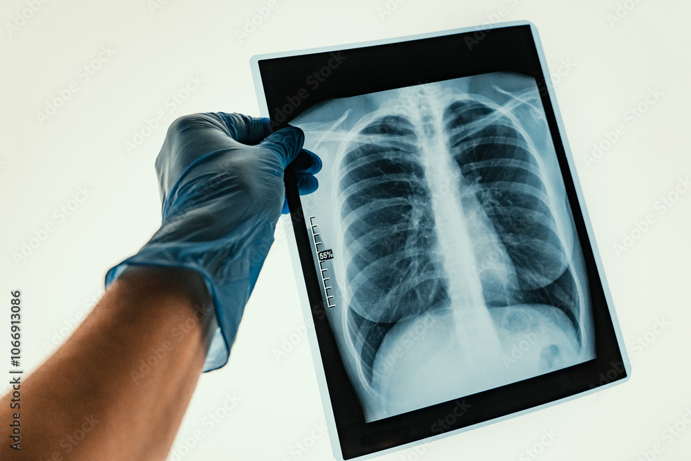 Xray Imaging of Human Lungs Conducted for Comprehensive Medical Analysis and Evaluation