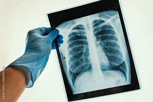 Obraz na płótnie Xray Imaging of Human Lungs Conducted for Comprehensive Medical Analysis and Evaluation w salonie