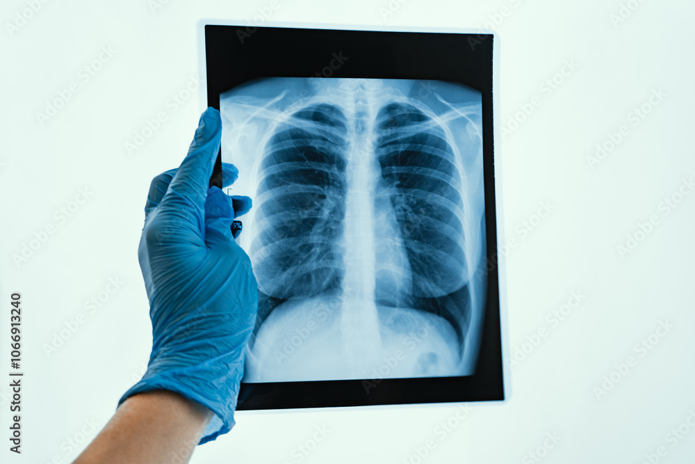 Xray Imaging of Human Lungs Conducted for Comprehensive Medical Analysis and Evaluation