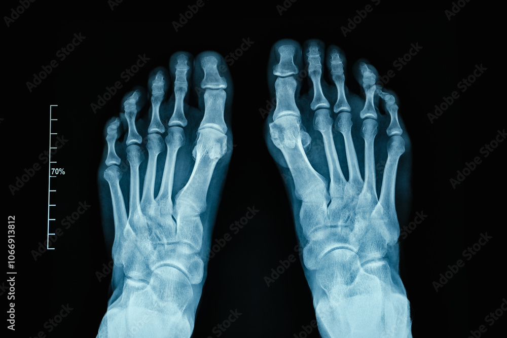 XRay Image of Human Feet Showing Intricate Bone Structure with Exceptional Detail