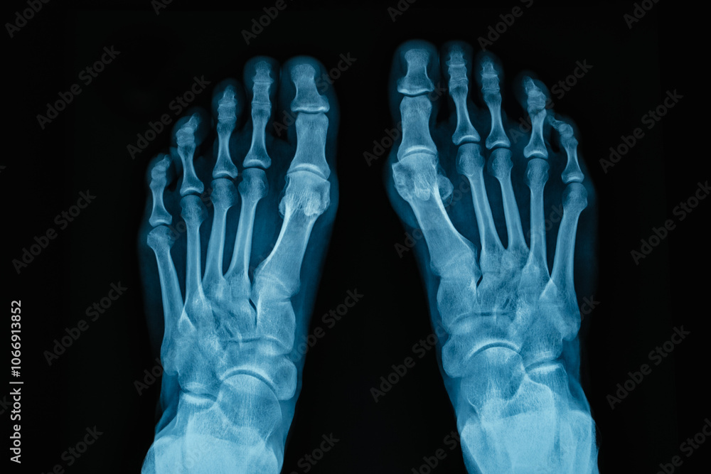 XRay Image of Human Feet Showing Intricate Bone Structure with Exceptional Detail