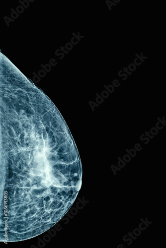 Obraz na płótnie Mammogram imaging is crucial for early breast cancer detection, enhancing womens health w salonie