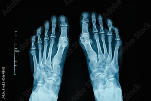 XRay Image of Human Feet Showing Intricate Bone Structure with Exceptional Detail photo