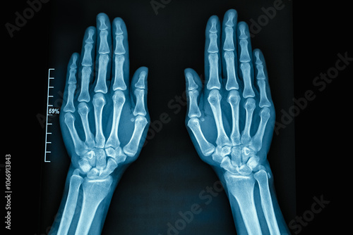 Obraz na płótnie XRay Image of Human Hands Displaying the Detailed Skeletal Structure Clearly Visible w salonie